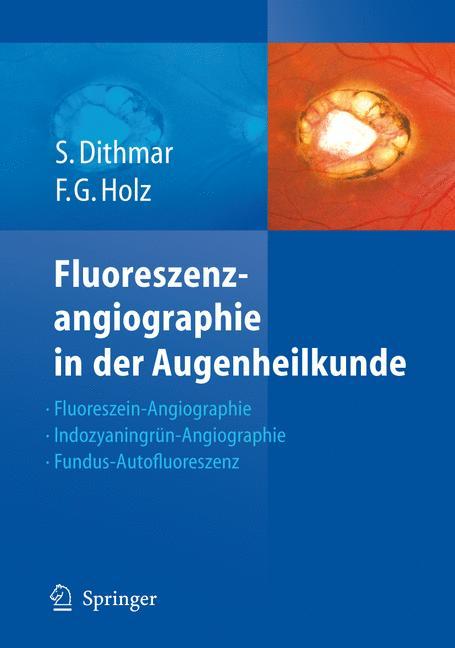 Fluoreszenzangiographie in der Augenheilkunde