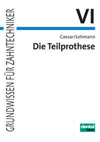 Die Teilprothese