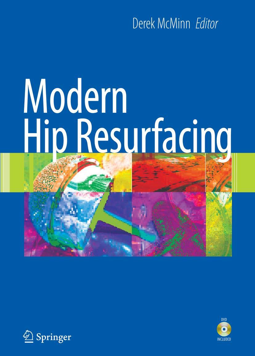 Modern Hip Resurfacing