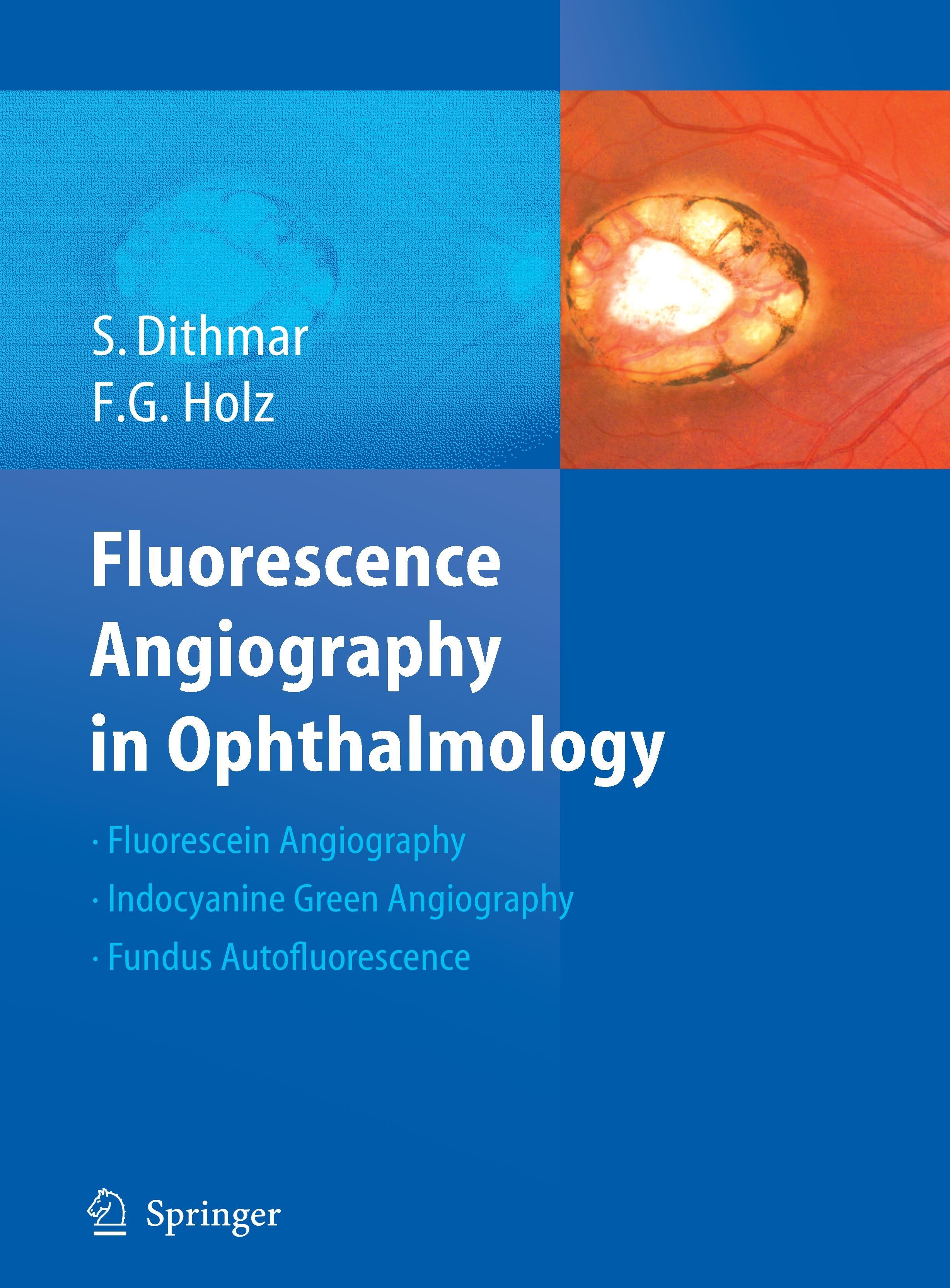 Fluorescence Angiography in Ophthalmology