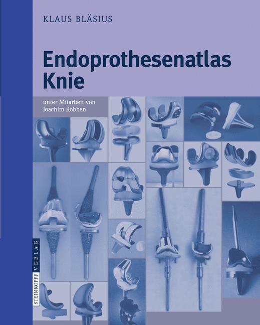 Endoprothesenatlas Knie