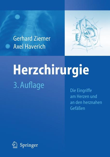 Herzchirurgie