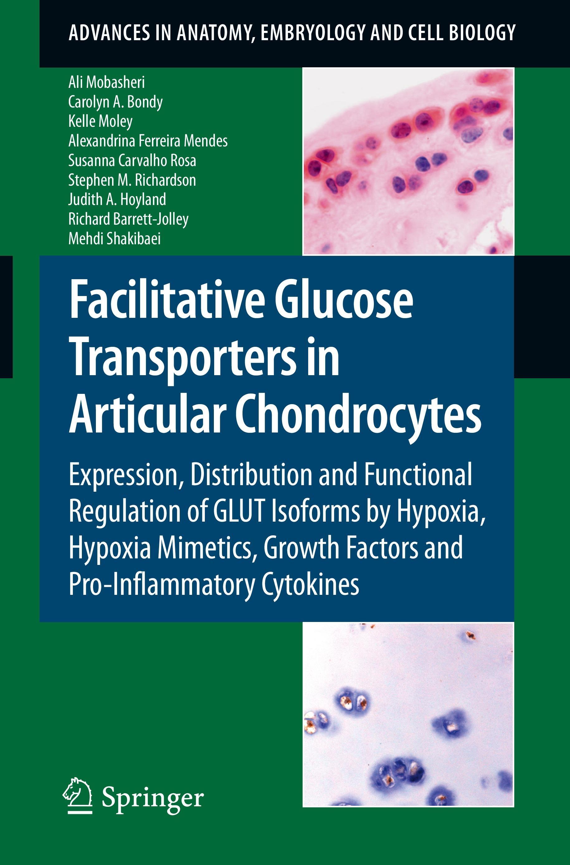 Facilitative Glucose Transporters in Articular Chondrocytes