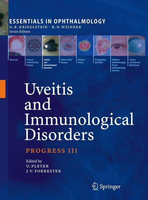 Uveitis and Immunological Disorders