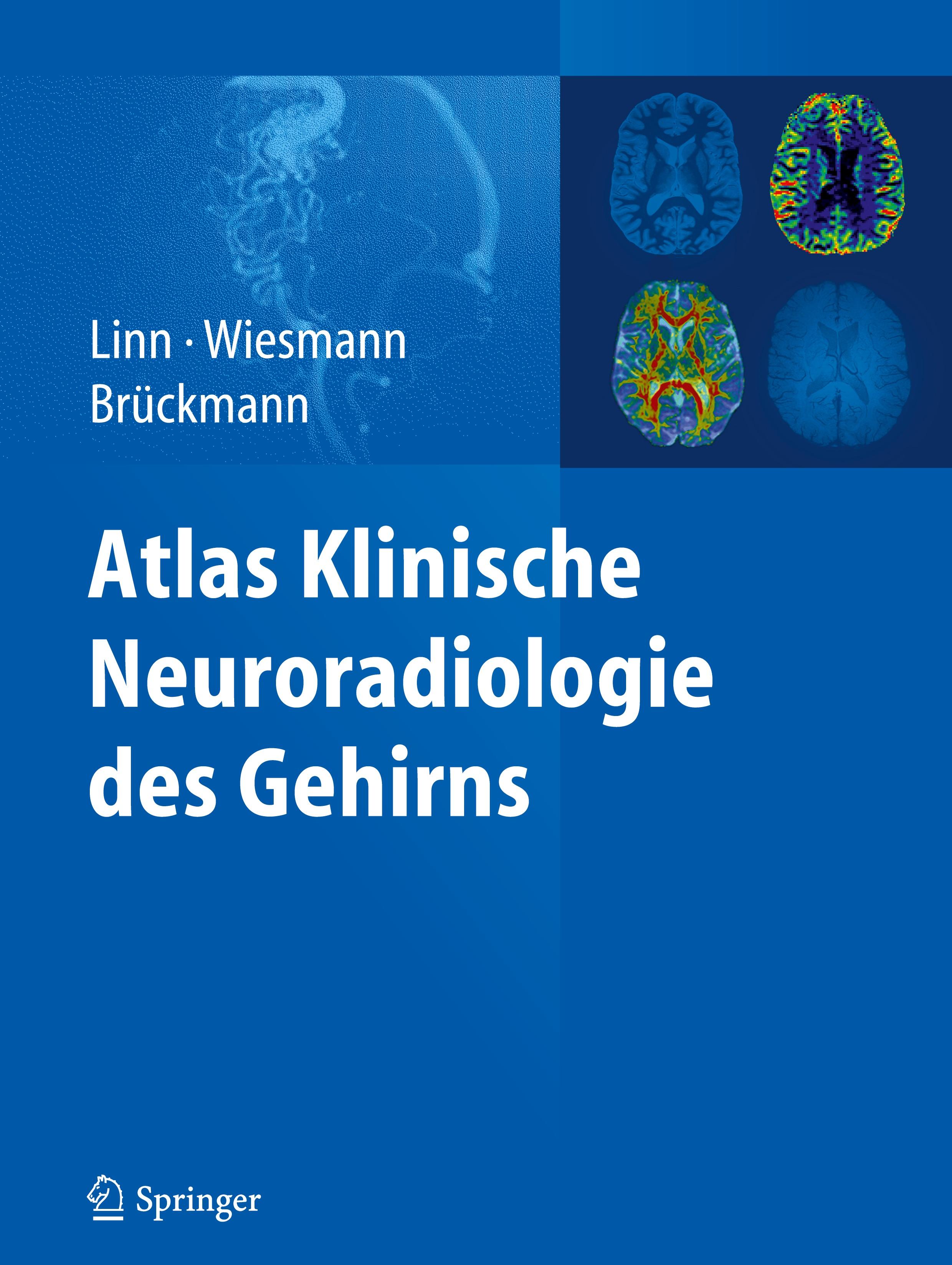 Atlas Klinische Neuroradiologie des Gehirns