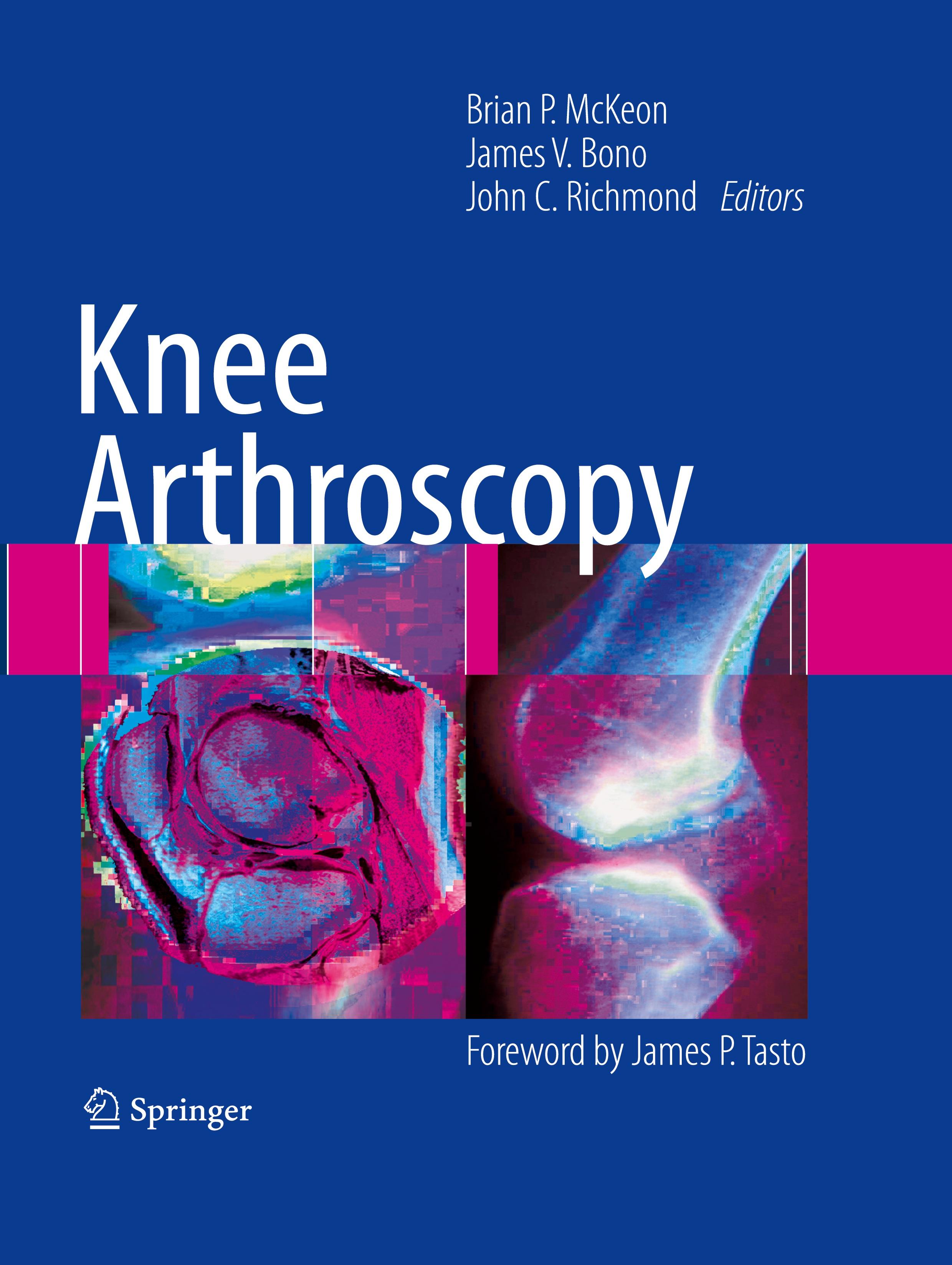 Knee Arthroscopy