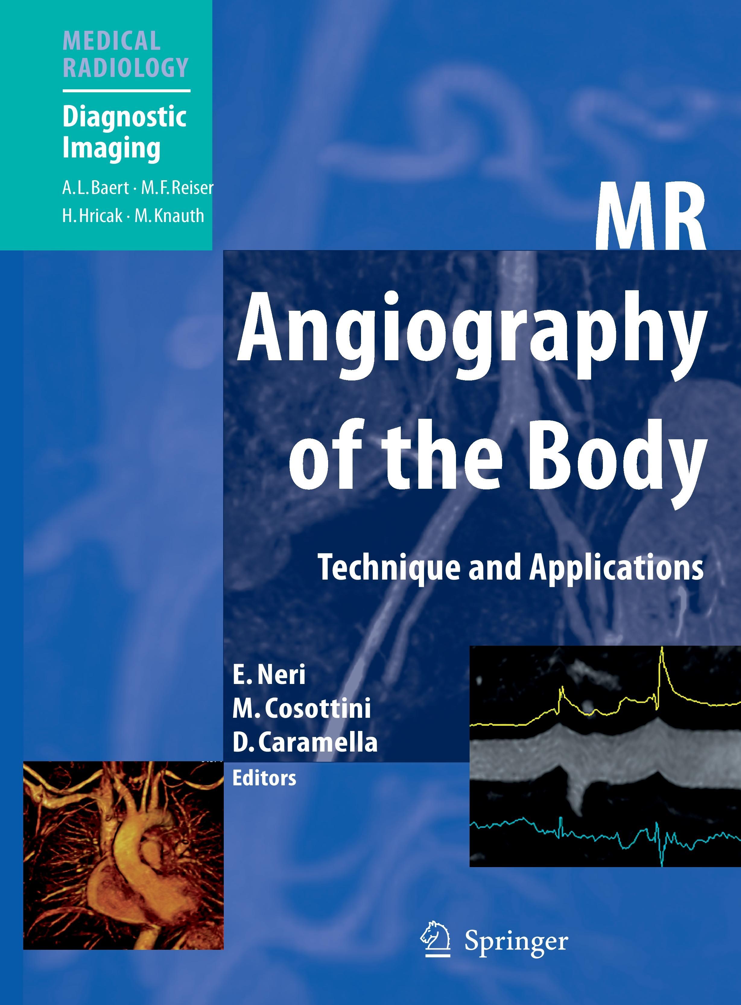 MR Angiography of the Body