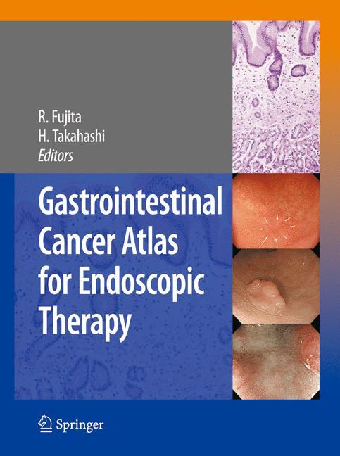 Gastrointestinal Cancer Atlas for Endoscopic Therapy