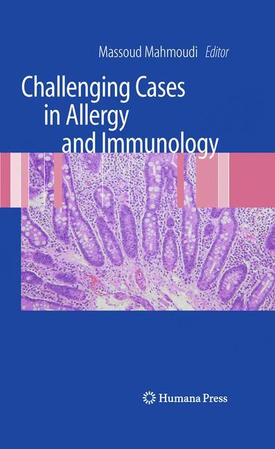 Challenging Cases in Allergy and Immunology