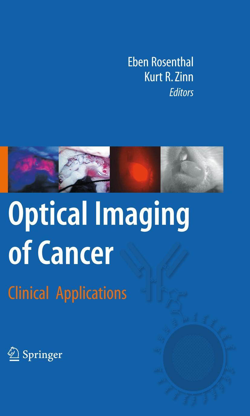 Optical Imaging of Cancer