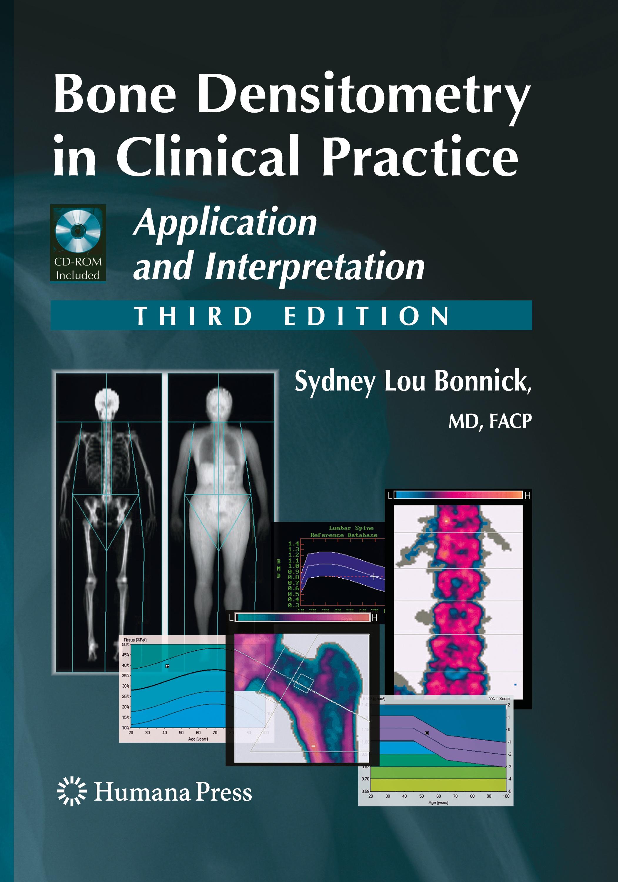 Bone Densitometry in Clinical Practice