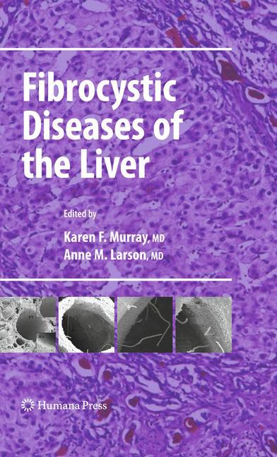 Fibrocystic Diseases of the Liver