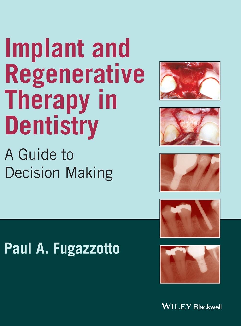 Implant and Regenerative Thera