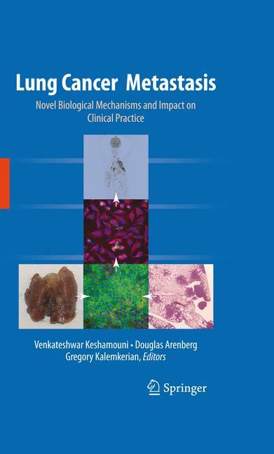 Lung Cancer Metastasis