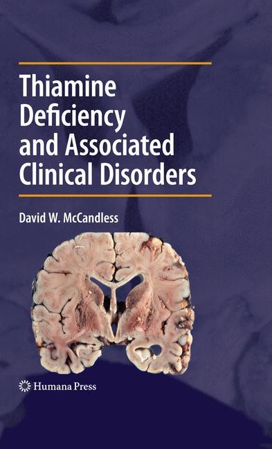 Thiamine Deficiency and Associated Clinical Disorders