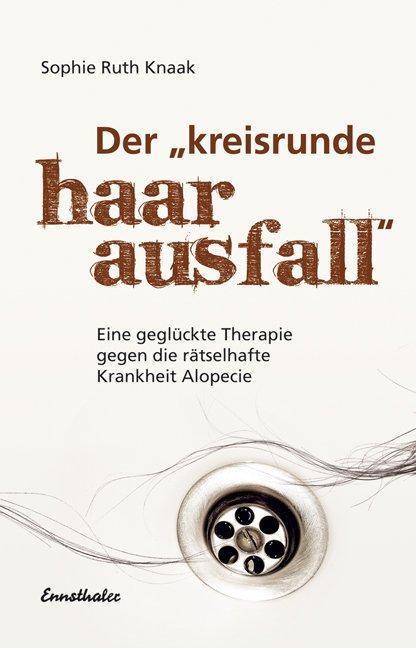 Der "kreisrunde Haarausfall"