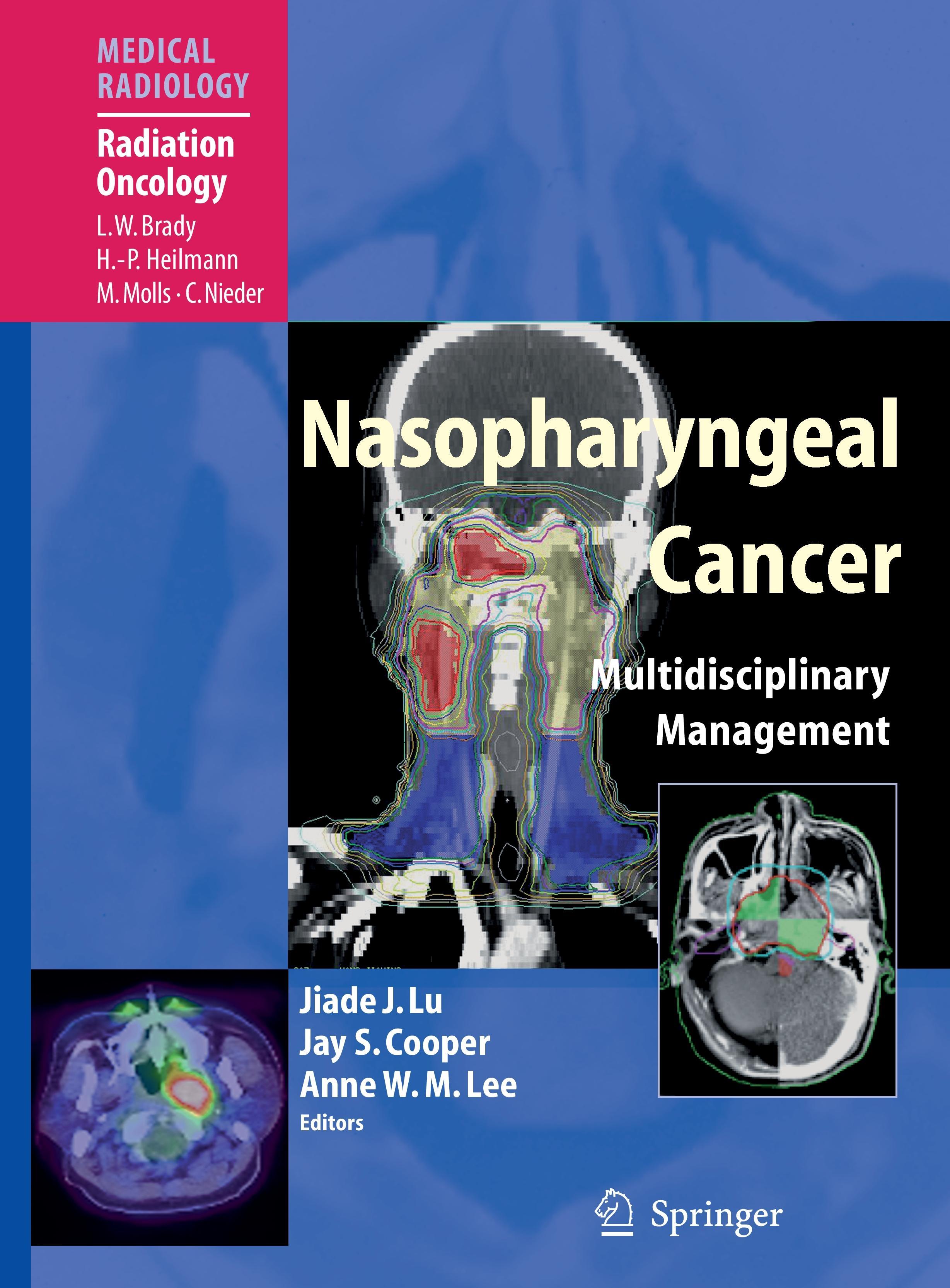 Nasopharyngeal Cancer