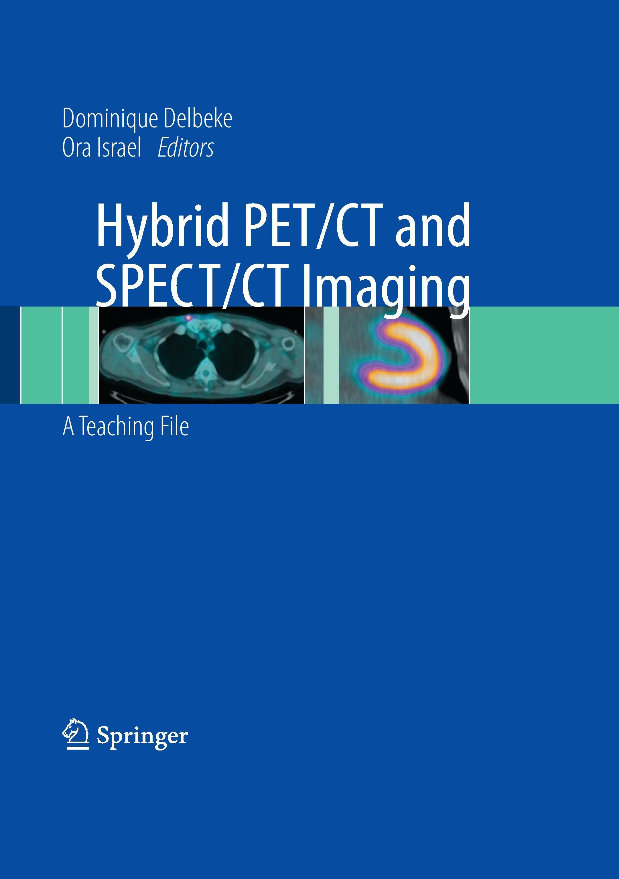 Hybrid PET/CT and SPECT/CT Imaging