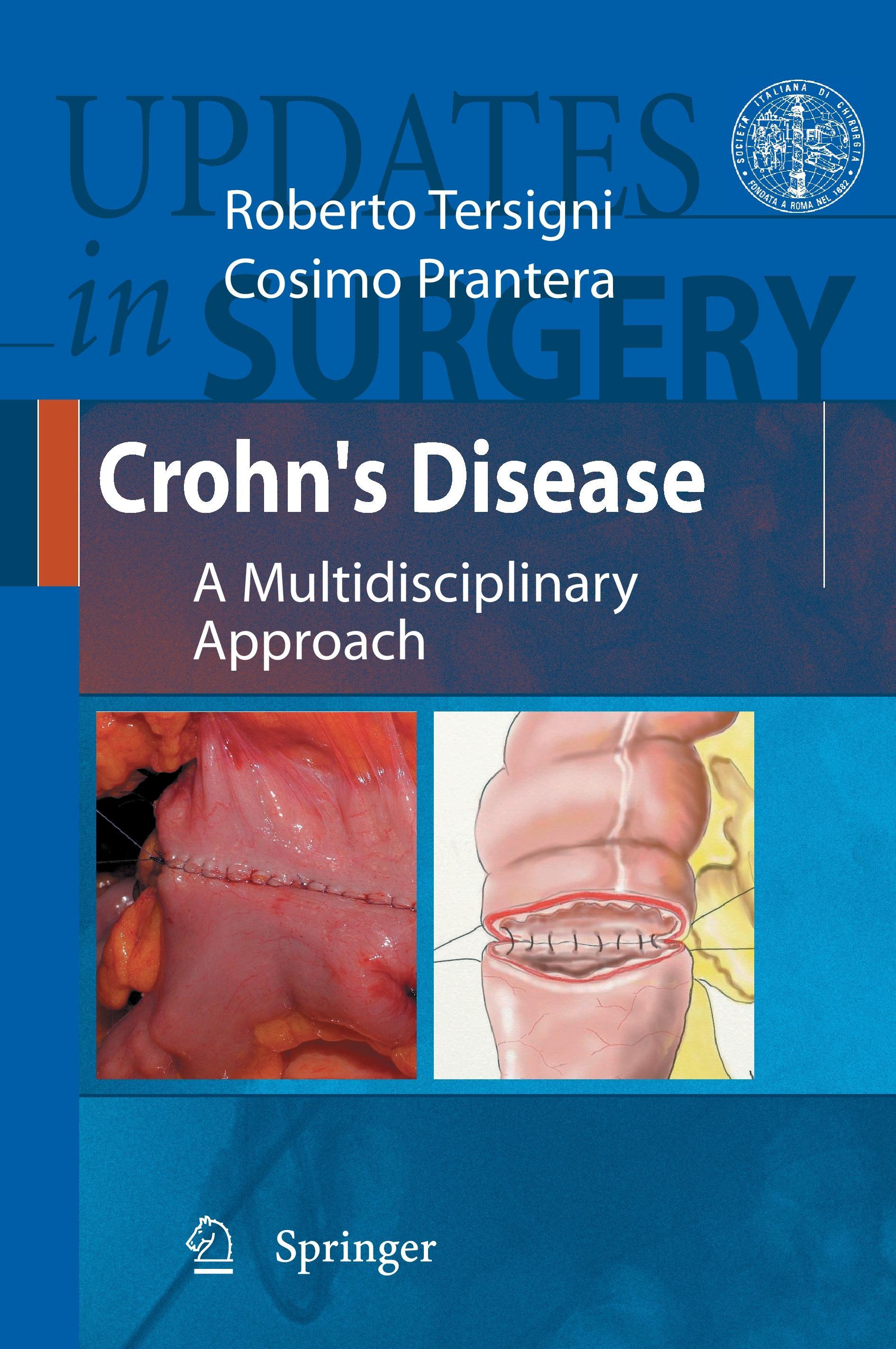 Crohn's Disease