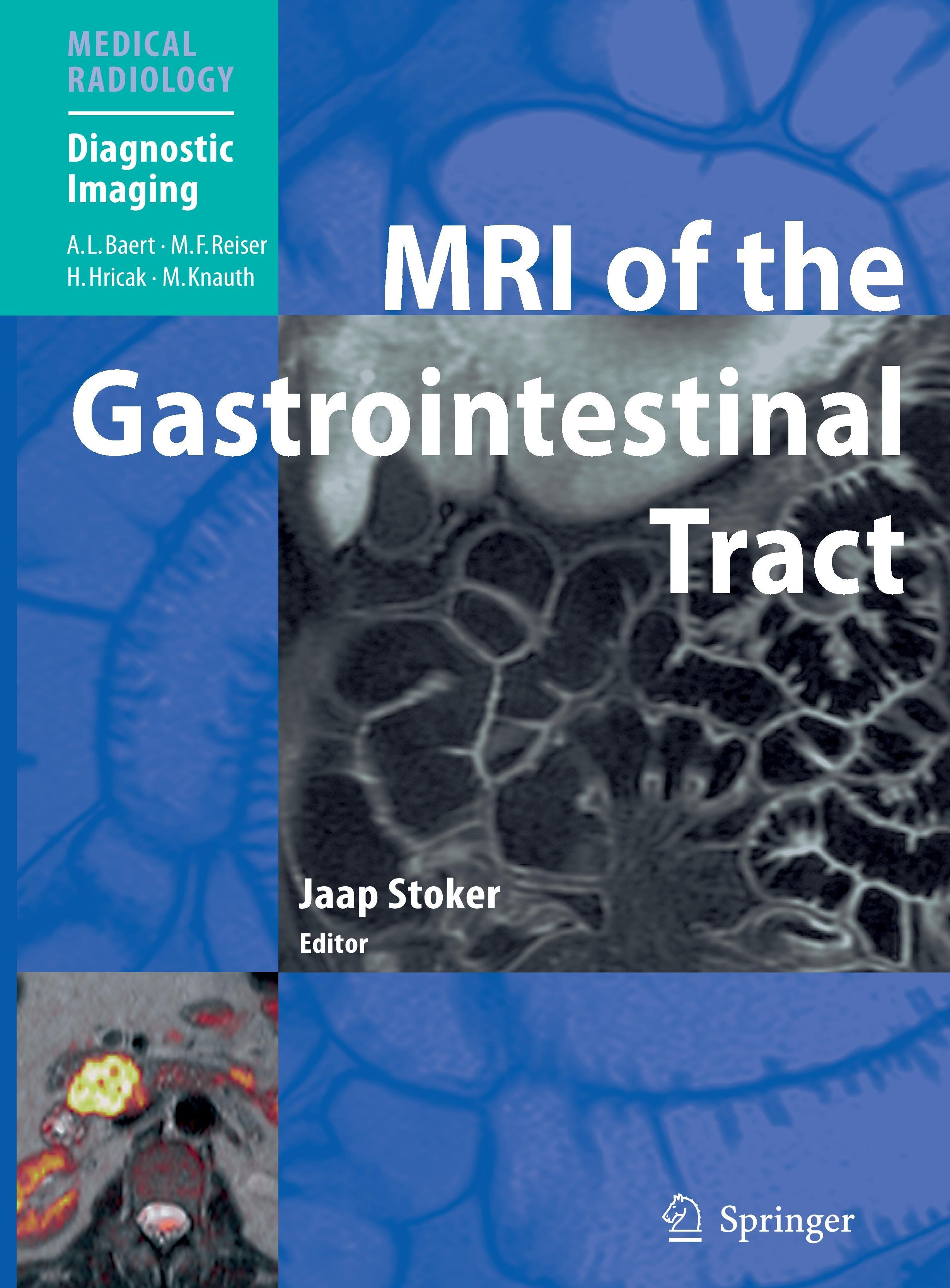 MRI of the Gastrointestinal Tract