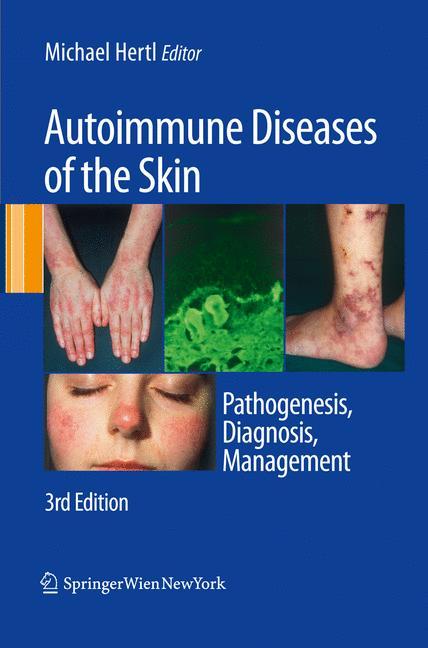 Autoimmune Diseases of the Skin