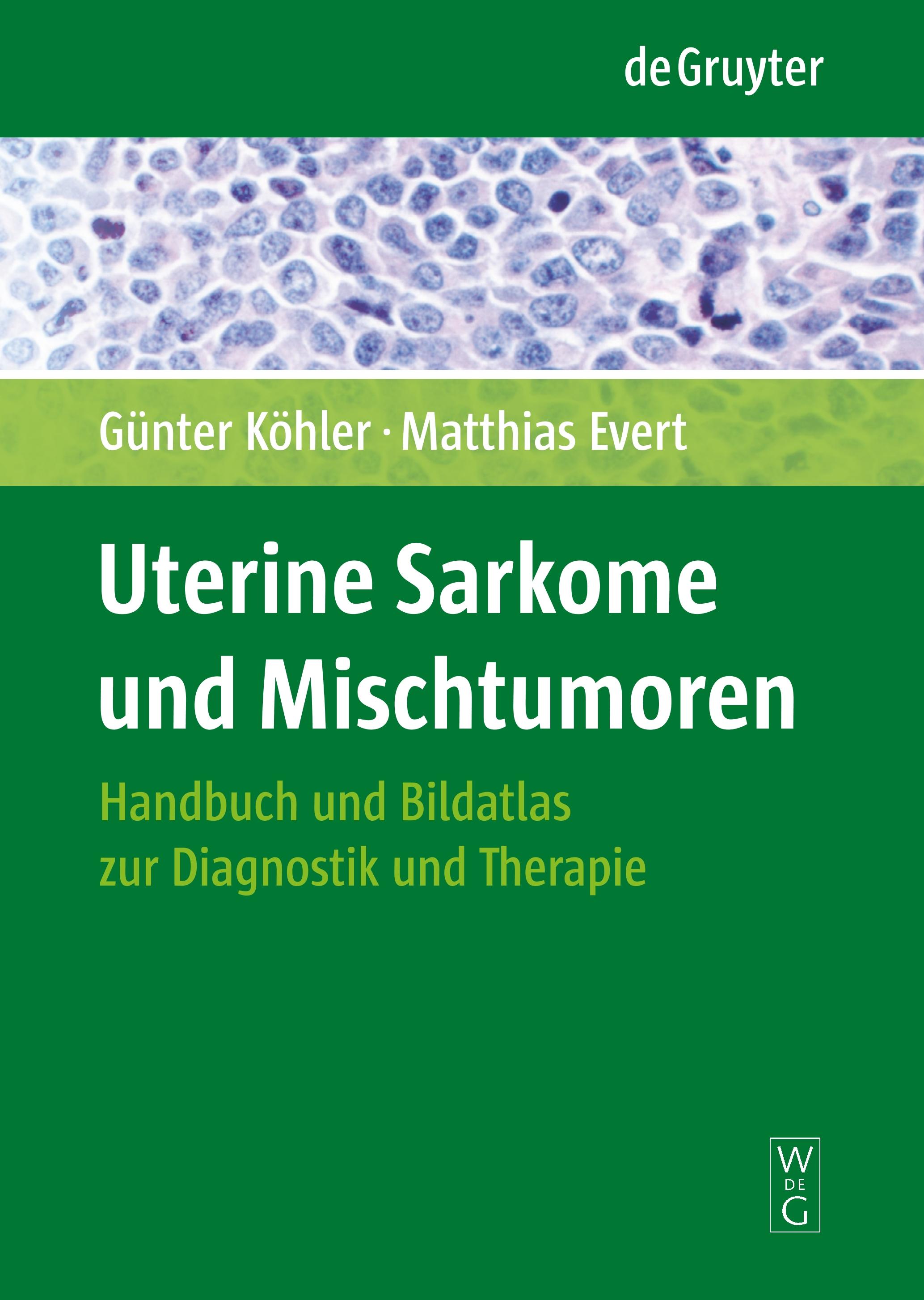 Uterine Sarkome und Mischtumoren