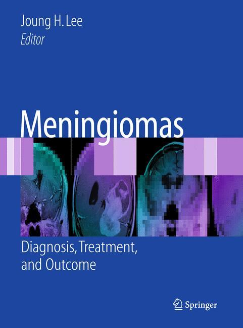 Meningiomas