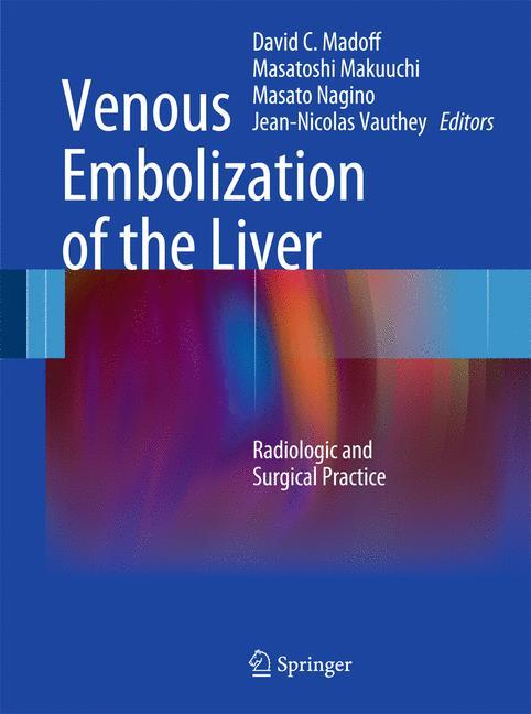 Venous Embolization of the Liver