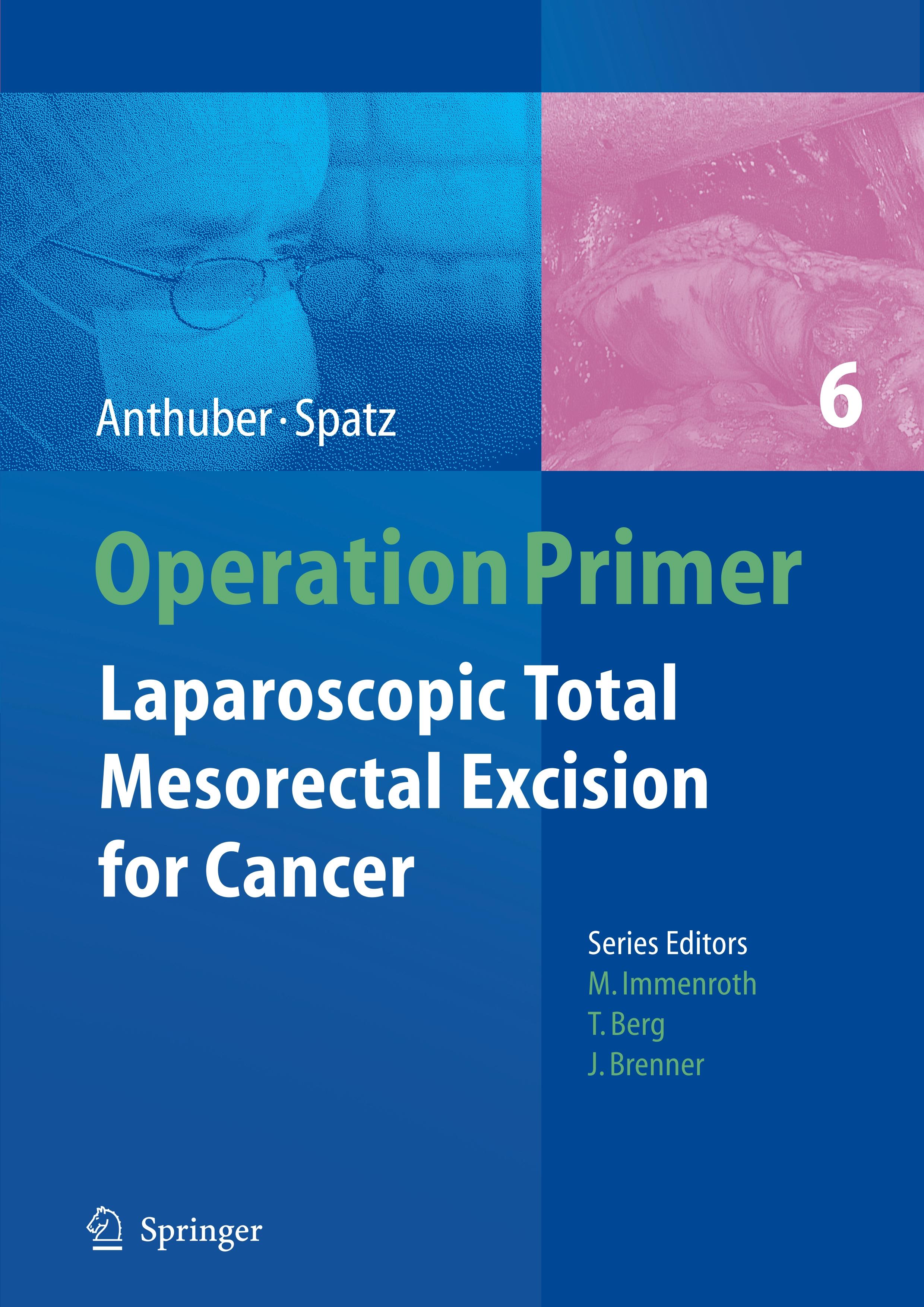 Laparoscopic Total Mesorectal Excision