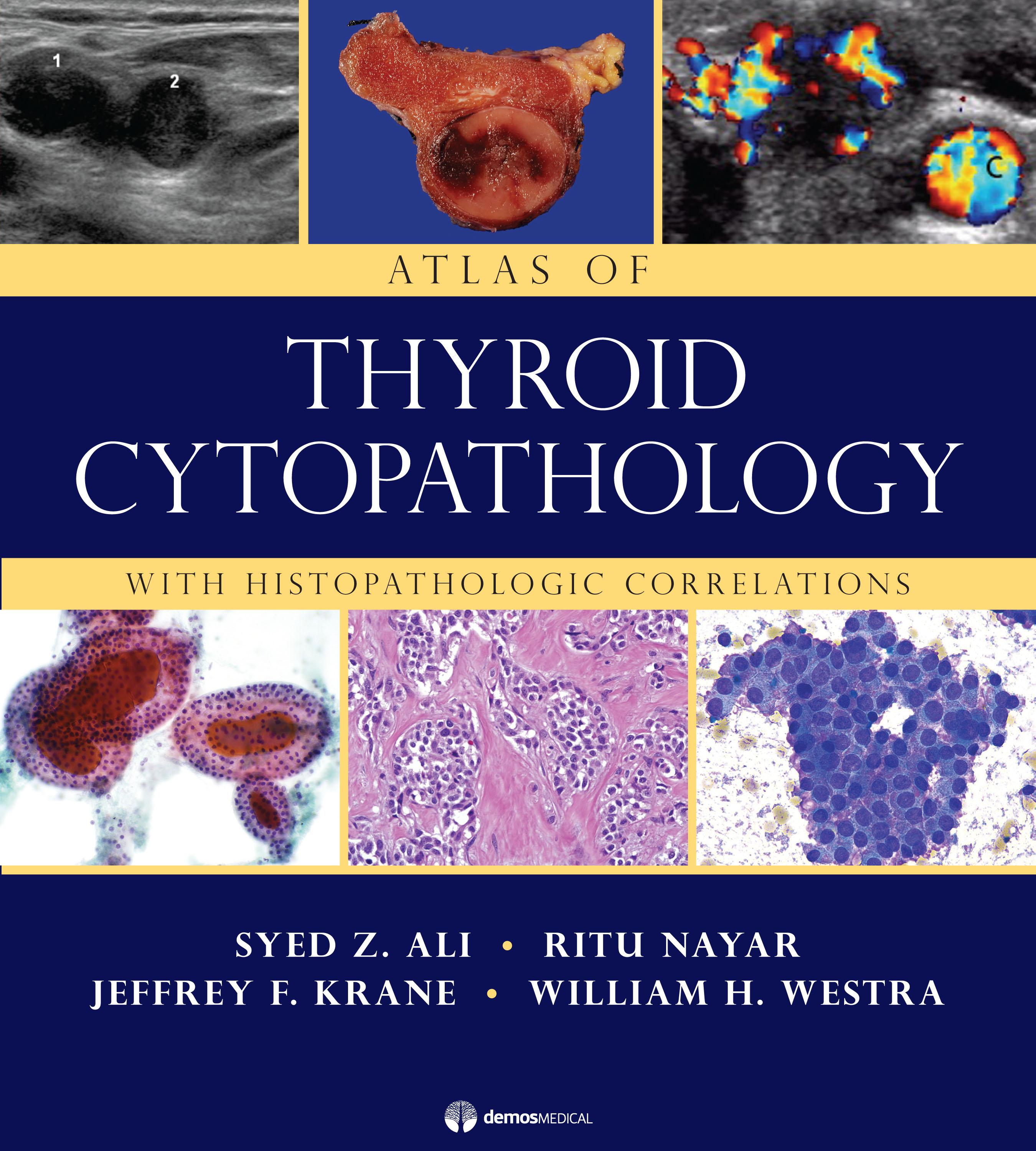 Atlas of Thyroid Cytopathology