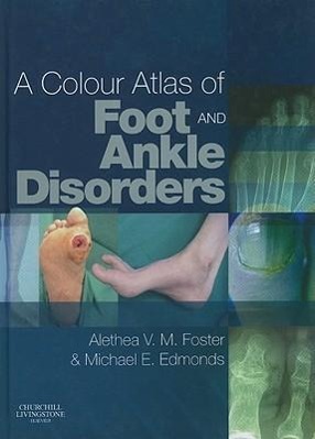 A Colour Atlas of Foot and Ankle Disorders