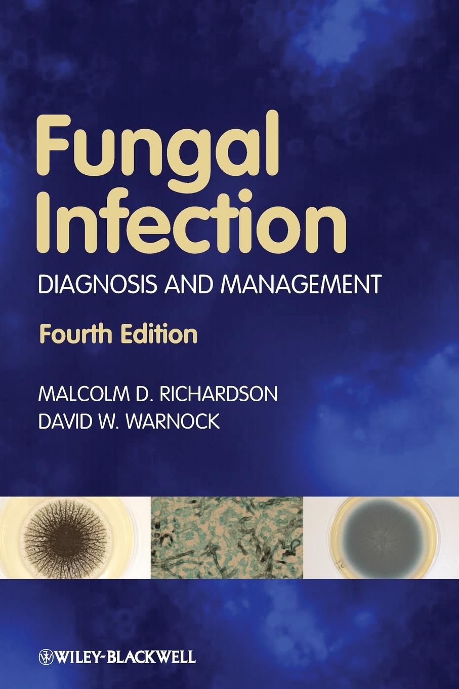 Fungal Infection 4e