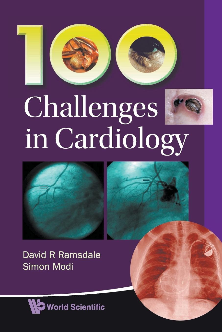 100 CHALLENGES IN CARDIOLOGY