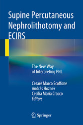 Supine Percutaneous Nephrolithotomy and ECIRS