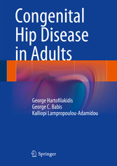 Congenital Hip Disease in Adults