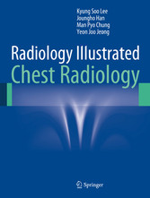 Radiology Illustrated: Chest Radiology