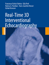 Real-Time 3D Interventional Echocardiography