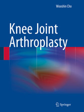 Knee Joint Arthroplasty