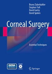 Corneal Surgery