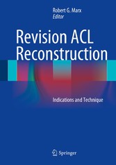 Revision ACL Reconstruction