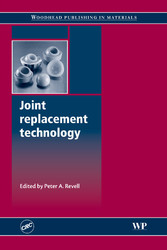 Joint Replacement Technology