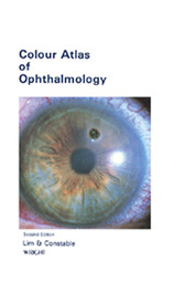 Colour Atlas of Ophthalmology