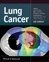 Lung Cancer