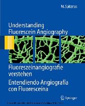 Understanding Fluorescein Angiography, Fluoreszeinangiografie verstehen, Entendiendo Angiografía con Fluoresceína