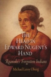 Head in Edward Nugent's Hand