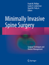 Minimally Invasive Spine Surgery