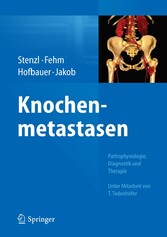 Knochenmetastasen