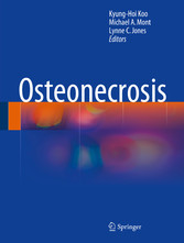 Osteonecrosis