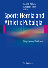 Sports Hernia and Athletic Pubalgia