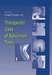 Therapeutic Uses of Botulinum Toxin